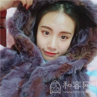 大连艺星,张景雷,*,案例,价格,
