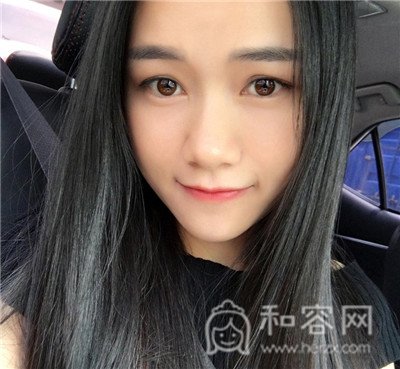 上海仁爱,杨苓山,面部填充,案例,价格,